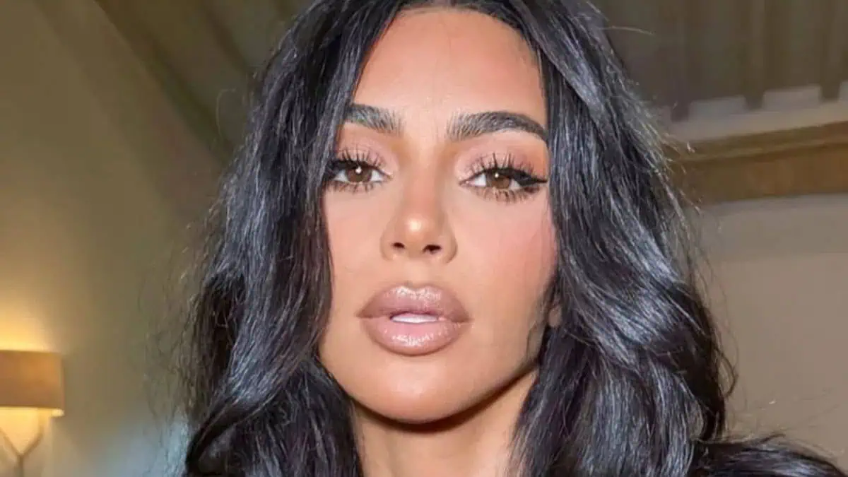 Kim Kardashian Sparks Concern With ‘Lots Of Bruises On Her Legs’