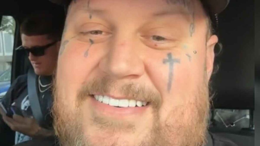 Jelly Roll Shows Off Dramatic Weight Loss at the 2024 CMAs: ‘I Wanna Feel Normal’ Jelly Roll