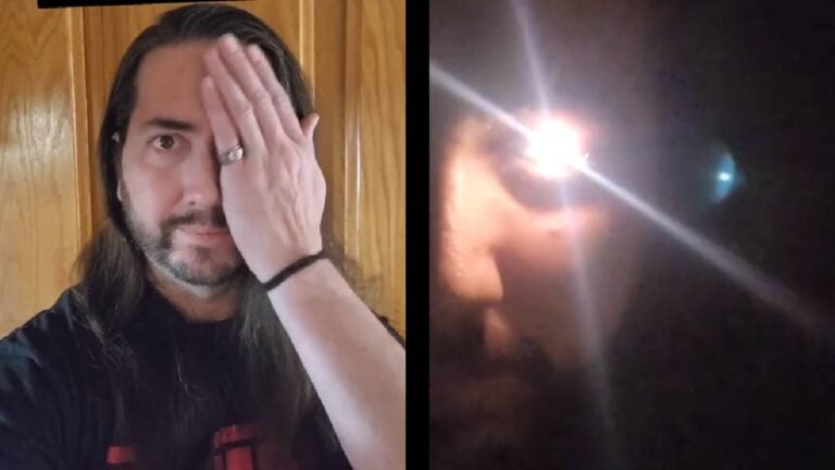 Southern California Man Goes Viral Because of His Cyborg Eye: ‘Stop Making Us Jealous of Your Magic Eyes’ California Man Cyborg Eye