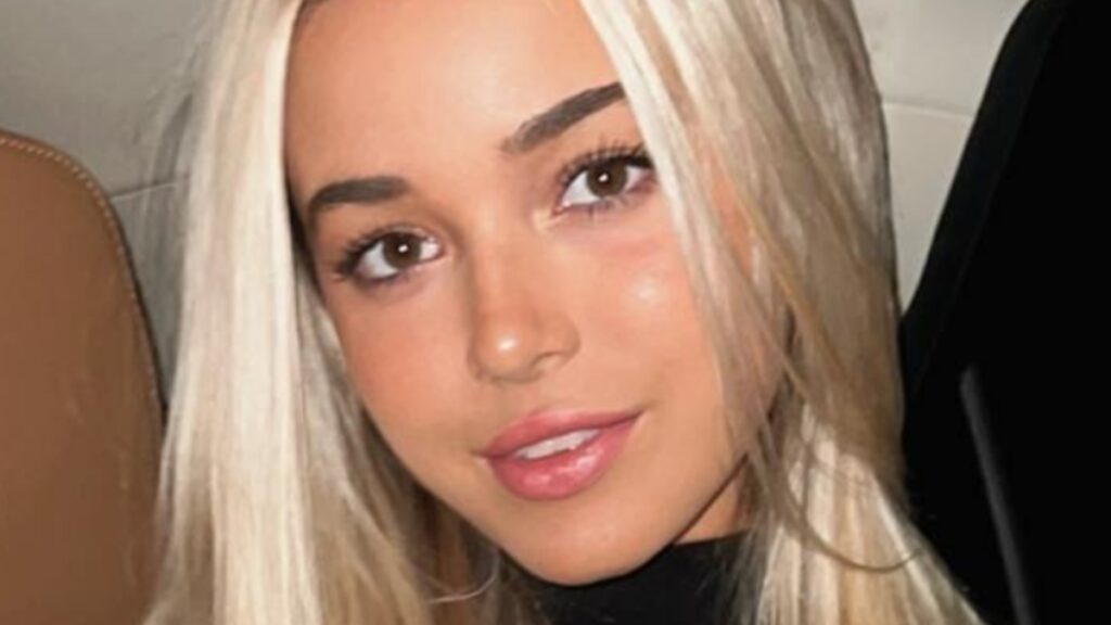 Gymnast Olivia Dunne ‘Overexposed’ In Minidress Flashing Backside Olivia Dunne close up