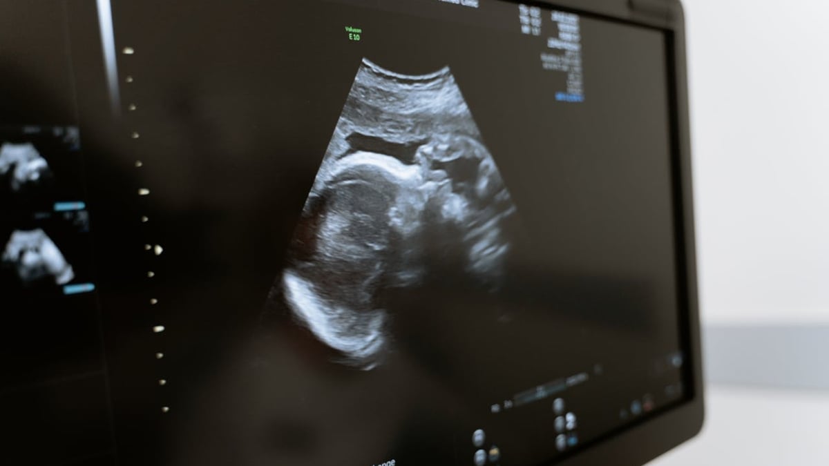 Georgia Doctors Forced to Keep Pregnant Brain Dead Woman Alive Due to Abortion Law: ‘Do We Just Wish for Suffering?’