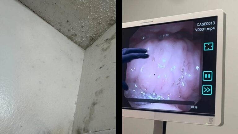 Tennessee Landlord Forces Tenant to Choke With Mold if They Don’t Pay Another Month’s Rent: ‘Take Him to Court’ Tennessee Choke Mold