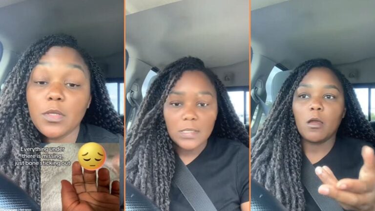 Shocked Florida Mother Recounts Terrifying Injury Daughter Sustained at Daycare: ‘This is Actually Unreal’ Shocked Florida Mother Recounts Terrifying Injury Daughter Sustained at Daycare 'This is Actually Unreal'