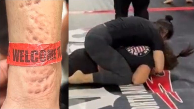 Petty Florida Woman Bites Opponent in Jiu-Jitsu Match, Still Loses Despite Cheating: ‘Someone was Hungry to Win’ Jiu-Jitsu match biter